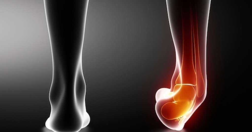 Tratamento Fisioterapêutico para Entorses e Lesões em Ligamentos: Guia Completo para Recuperação