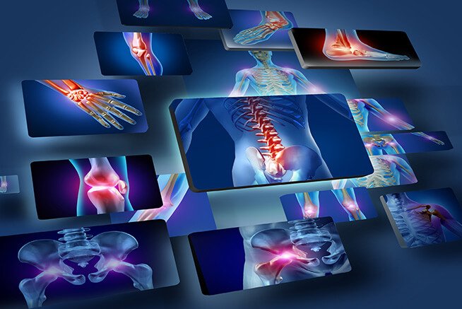 Principais Técnicas de Avaliação Traumato-Ortopédica: Como identificar disfunções musculoesqueléticas